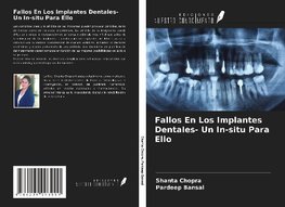 Fallos En Los Implantes Dentales- Un In-situ Para Ello