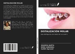 DISTALIZACIÓN MOLAR