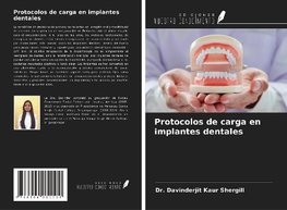 Protocolos de carga en implantes dentales