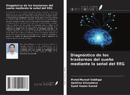 Diagnóstico de los trastornos del sueño mediante la señal del EEG