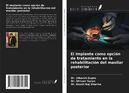 El implante como opción de tratamiento en la rehabilitación del maxilar posterior