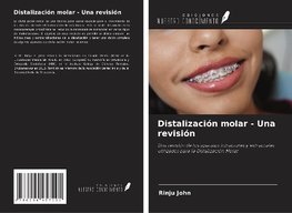 Distalización molar - Una revisión