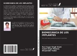 BIOMECÁNICA DE LOS IMPLANTES