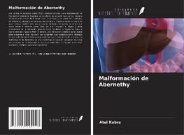 Malformación de Abernethy