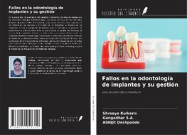 Fallos en la odontología de implantes y su gestión