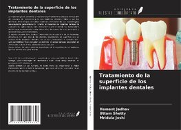 Tratamiento de la superficie de los implantes dentales