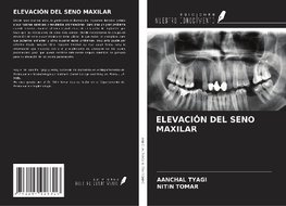 ELEVACIÓN DEL SENO MAXILAR