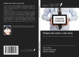 Pólipos del colon y del recto