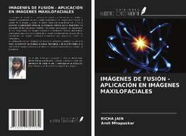 IMÁGENES DE FUSIÓN - APLICACIÓN EN IMÁGENES MAXILOFACIALES