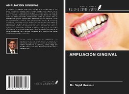 AMPLIACIÓN GINGIVAL