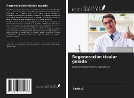 Regeneración tisular guiada