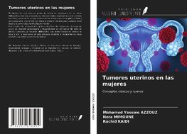 Tumores uterinos en las mujeres