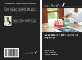 Consideración protésica de los implantes