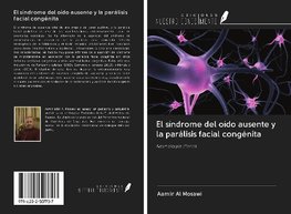 El síndrome del oído ausente y la parálisis facial congénita