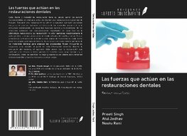 Las fuerzas que actúan en las restauraciones dentales