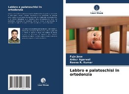 Labbro e palatoschisi in ortodonzia