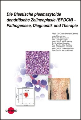 Die Blastische plasmazytoide dendritische Zellneoplasie (BPDCN) - Pathogenese, Diagnostik und Therapie