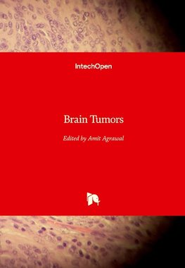 Brain Tumors