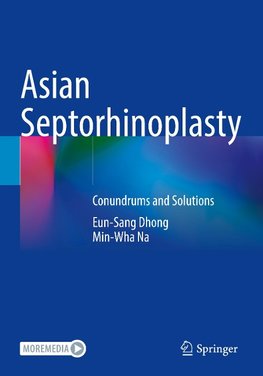 Asian Septorhinoplasty