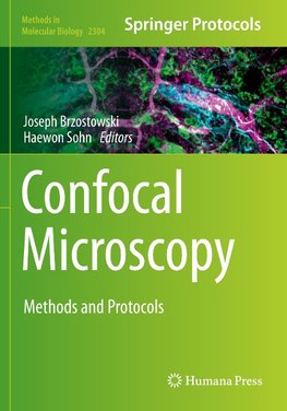 Confocal Microscopy