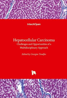 Hepatocellular Carcinoma