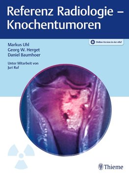 Referenz Radiologie - Knochentumoren