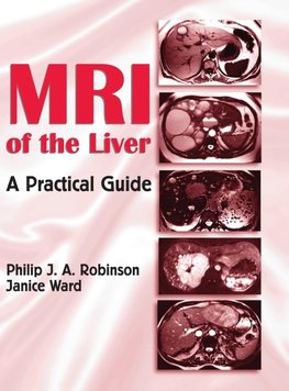 MRI of the Liver