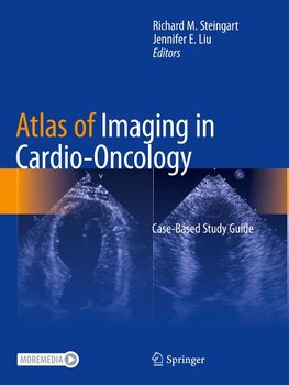 Atlas of Imaging in Cardio-Oncology