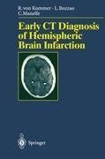 Early CT Diagnosis of Hemispheric Brain Infarction