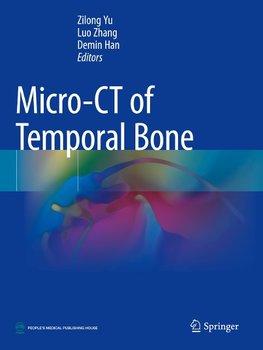 Micro-CT of Temporal Bone