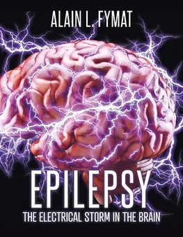 Epilepsy