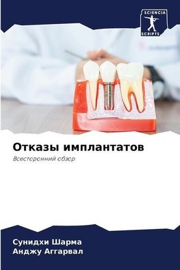 Otkazy implantatow