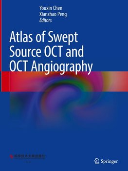 Atlas of Swept Source OCT and OCT Angiography