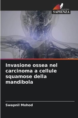 Invasione ossea nel carcinoma a cellule squamose della mandibola