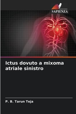 Ictus dovuto a mixoma atriale sinistro