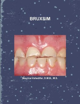 BRUXSIM