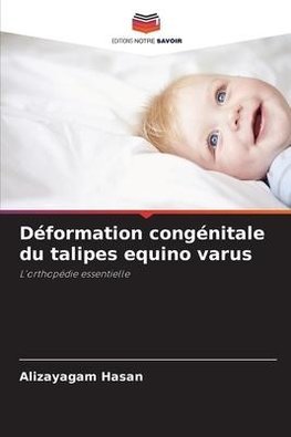 Déformation congénitale du talipes equino varus