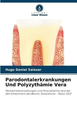 Parodontalerkrankungen Und Polyzythämie Vera