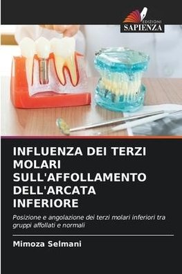 INFLUENZA DEI TERZI MOLARI SULL'AFFOLLAMENTO DELL'ARCATA INFERIORE