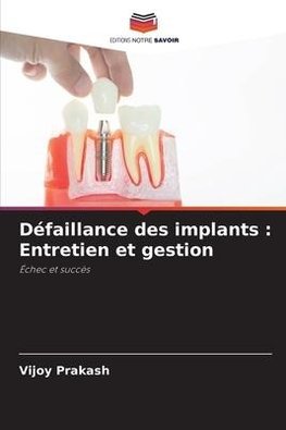 Défaillance des implants : Entretien et gestion