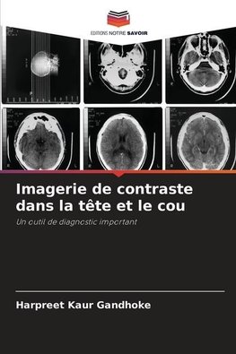 Imagerie de contraste dans la tête et le cou