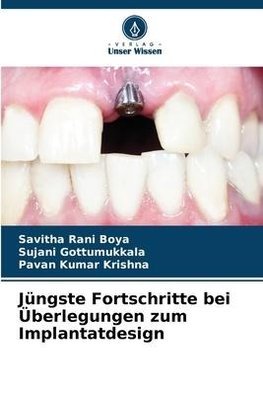 Jüngste Fortschritte bei Überlegungen zum Implantatdesign