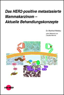 Das HER2-positive metastasierte Mammakarzinom - Aktuelle Behandlungskonzepte