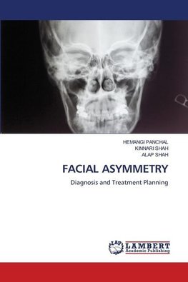 FACIAL ASYMMETRY