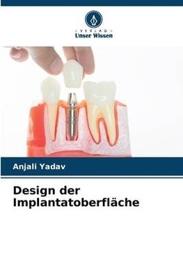 Design der Implantatoberfläche