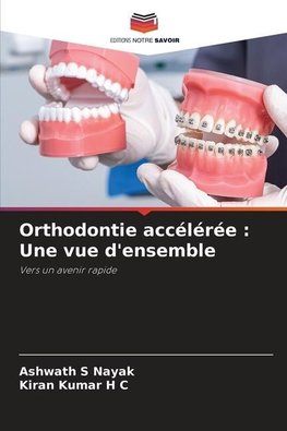 Orthodontie accélérée : Une vue d'ensemble