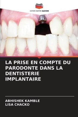 LA PRISE EN COMPTE DU PARODONTE DANS LA DENTISTERIE IMPLANTAIRE