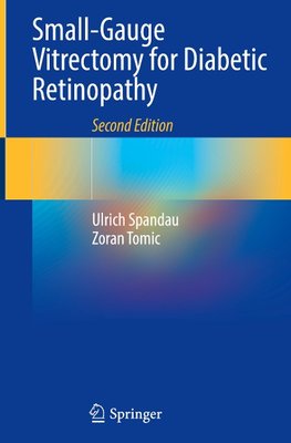 Small-Gauge Vitrectomy for Diabetic Retinopathy