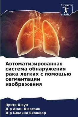 Awtomatizirowannaq sistema obnaruzheniq raka legkih s pomosch'ü segmentacii izobrazheniq