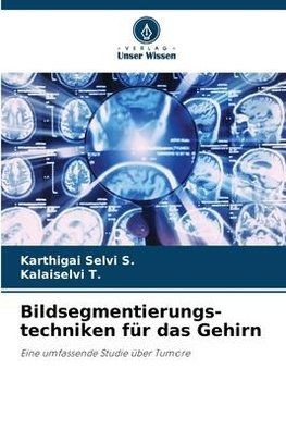 Bildsegmentierungs- techniken für das Gehirn